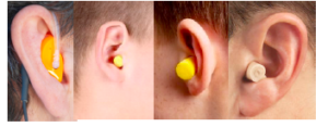 Hearing Protection Device 