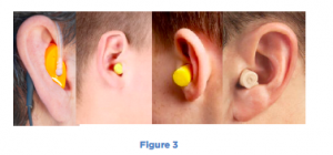 Ear Impression molds